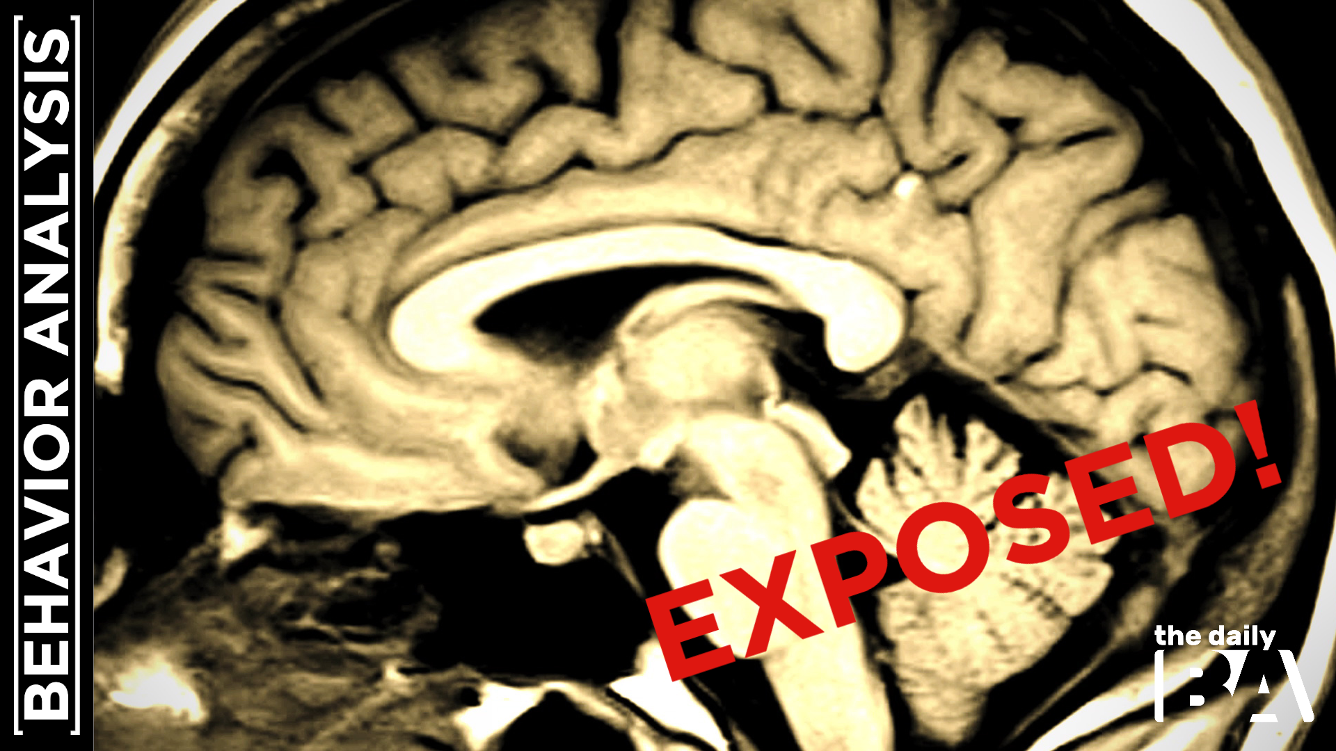 Right Brain vs. Left Brain Personality (MYTH EXPOSED)