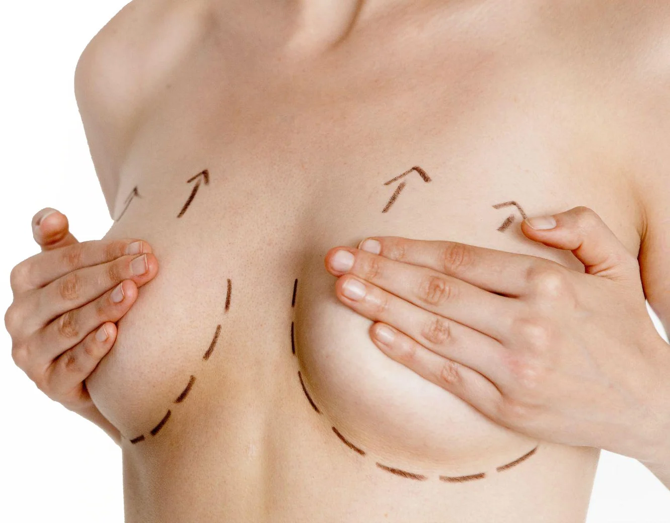 breast-lift1134567.jpg