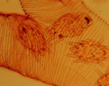tracheal mite