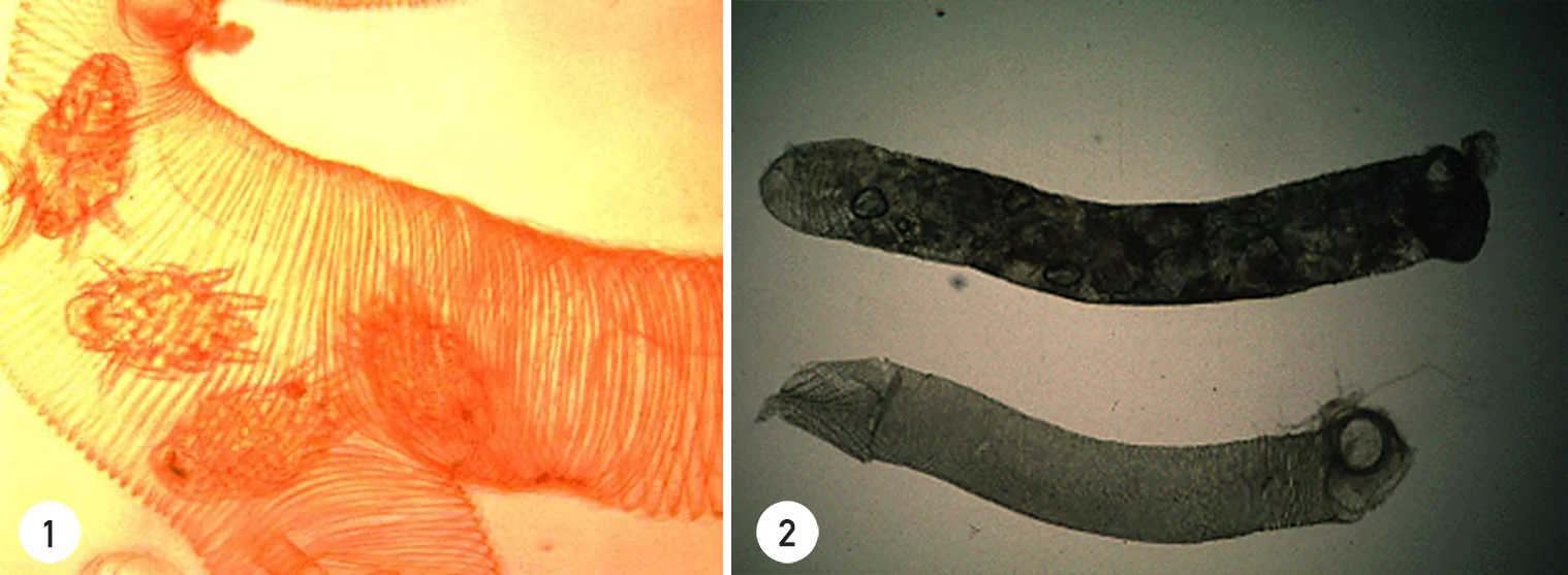  Non-infested healthy tracheae appear transparent and clear-amber