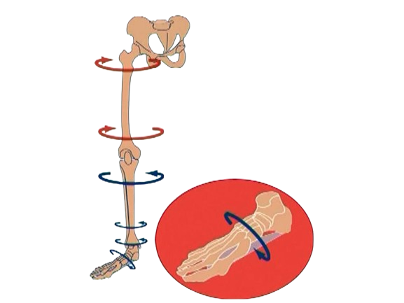 Speed Approach to ACL Rehabilitation