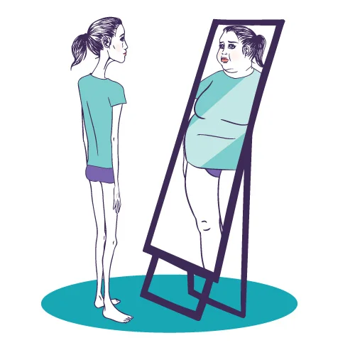anorexia nervosa