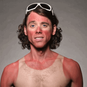 Sunburn-Vest.png