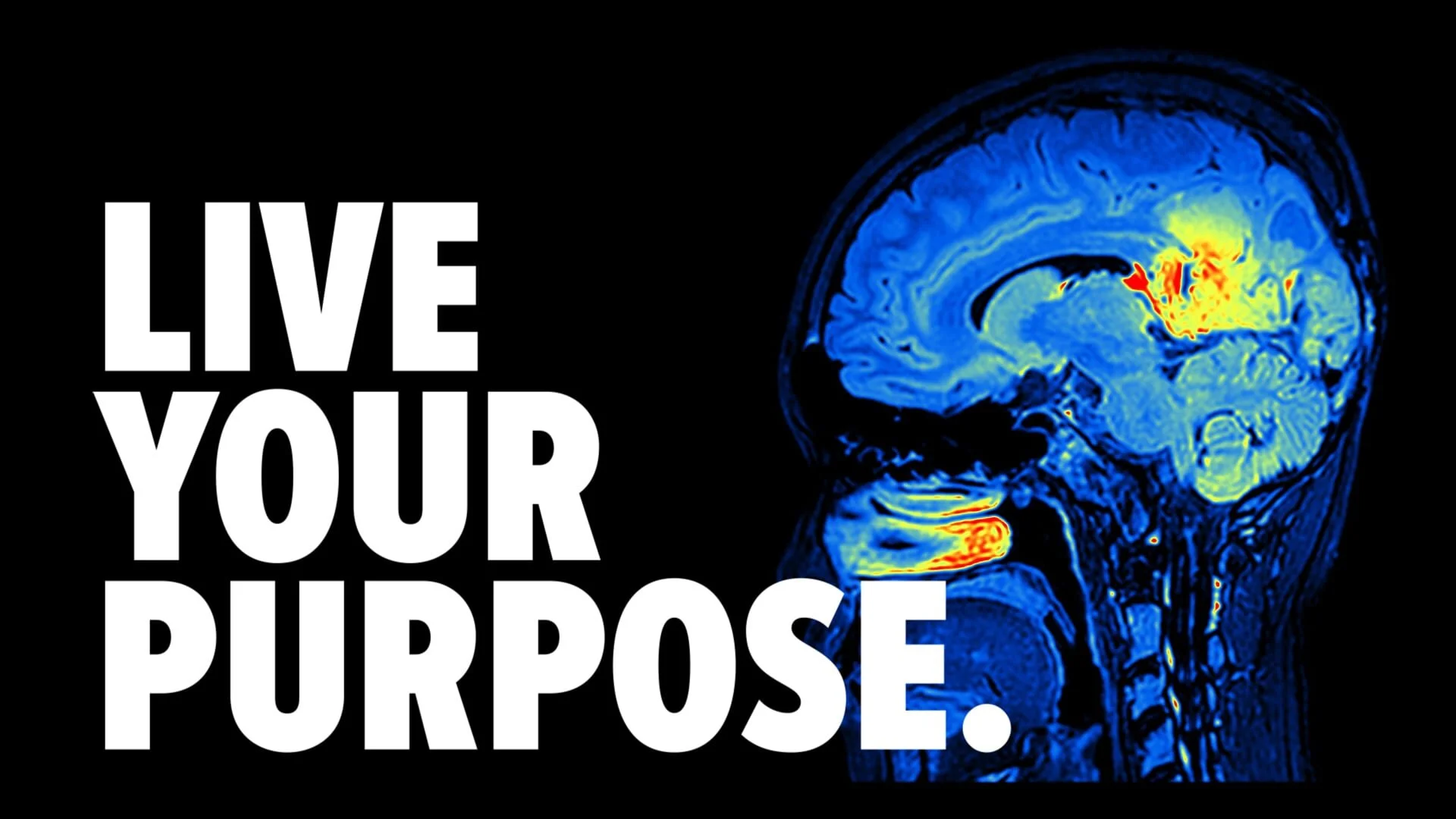MRI scan of a human brain with colorful highlights, next to "Live Your Purpose" text on a black background.
