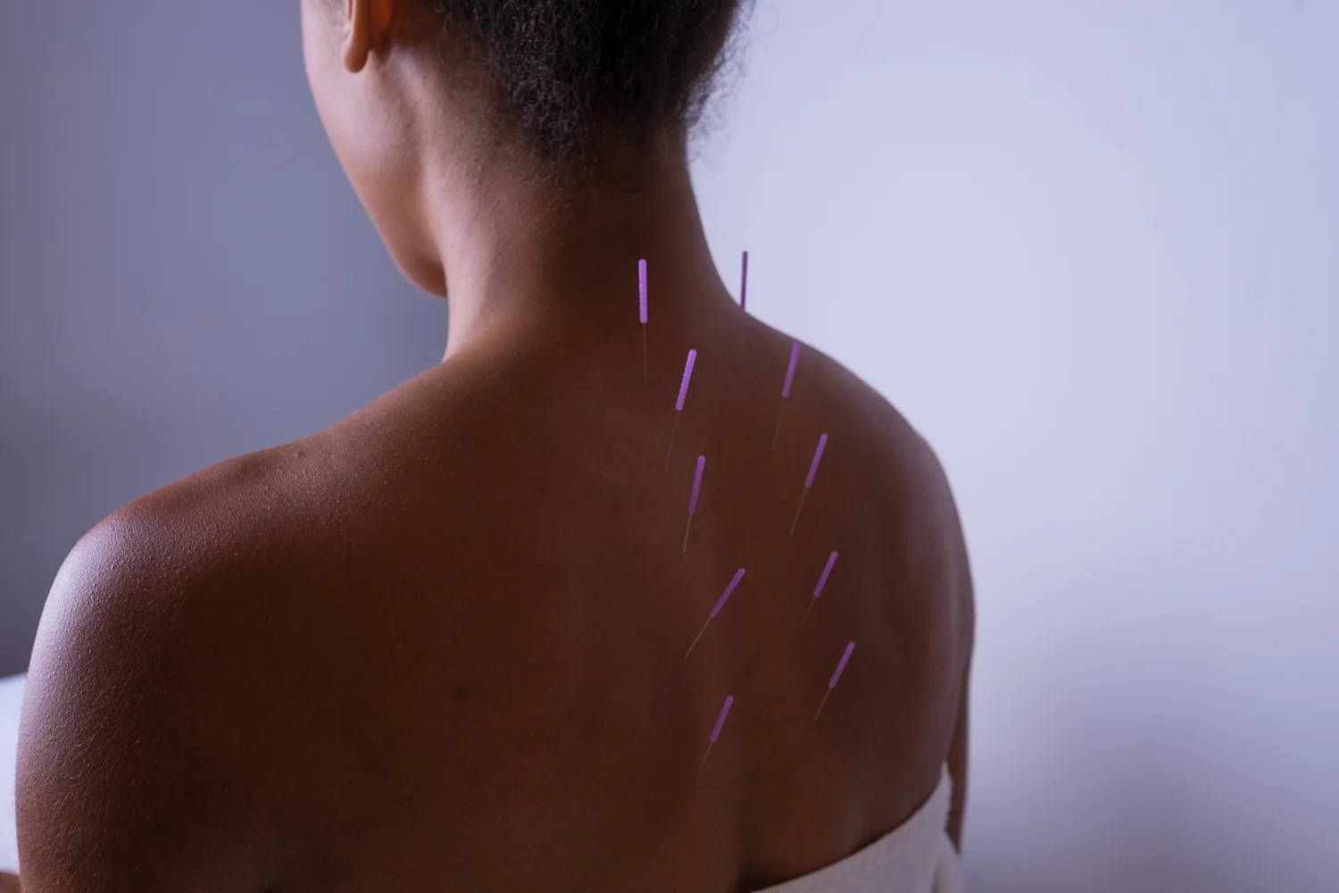Emily_Grace_Acupuncture_Acu.jpg