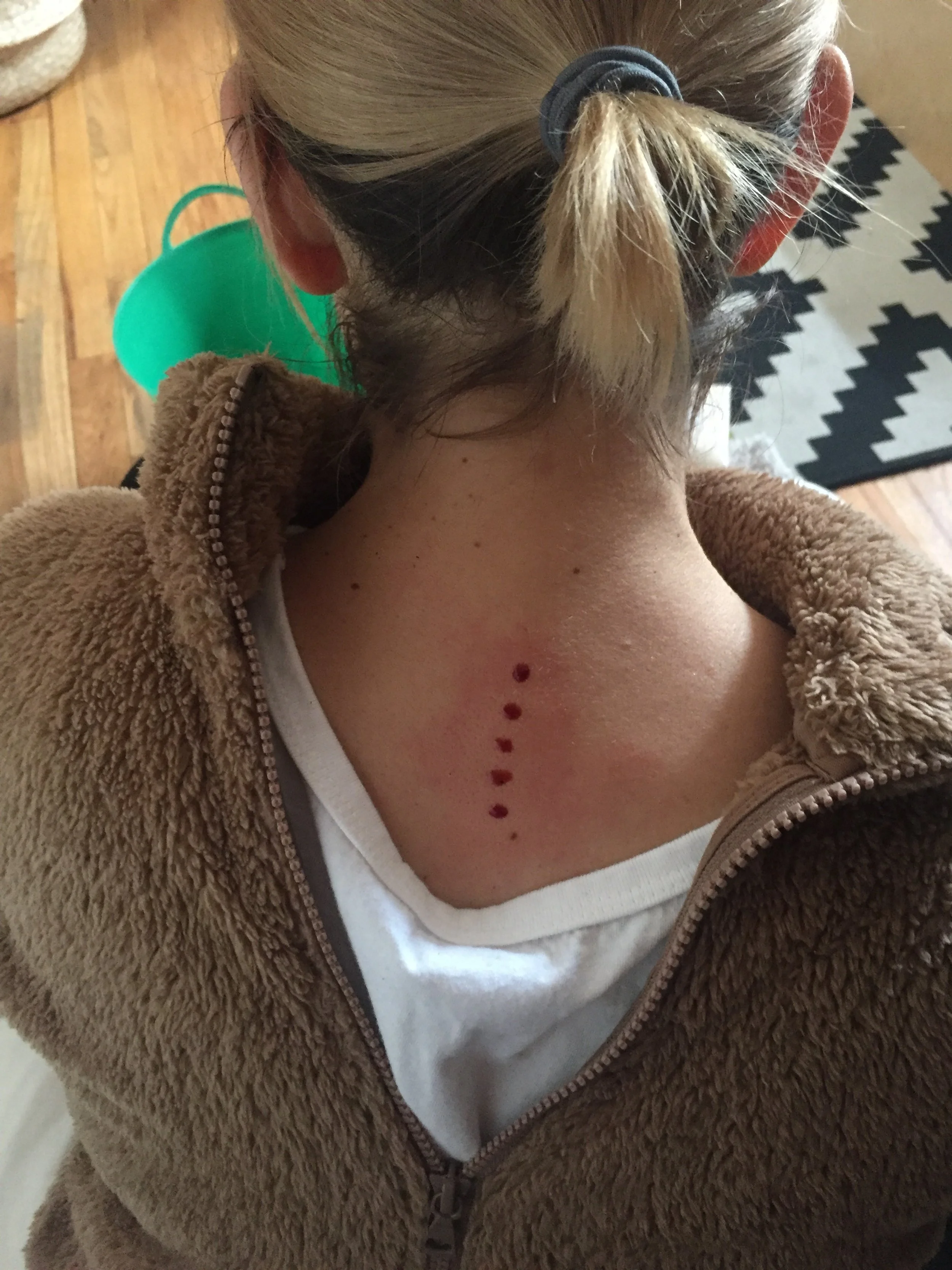 Shamanic Medicine Ceremony with Kambo Care