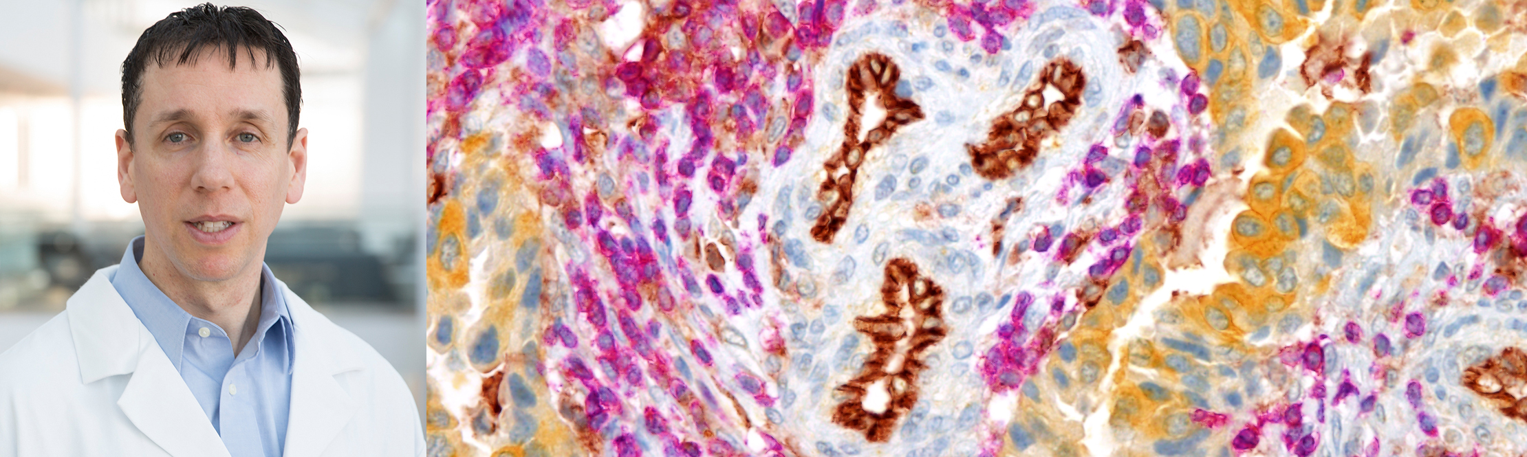 GB+Histo_1.jpg