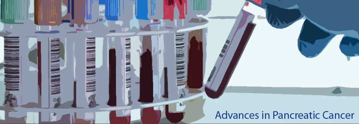 A review of significant clinical, translational, and basic science advances in pancreatic cancer. Disclosure: Publications listed are based on independent review by the Beatty Laboratory.