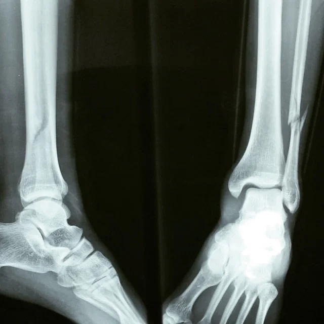 Indestructible, otra vez.