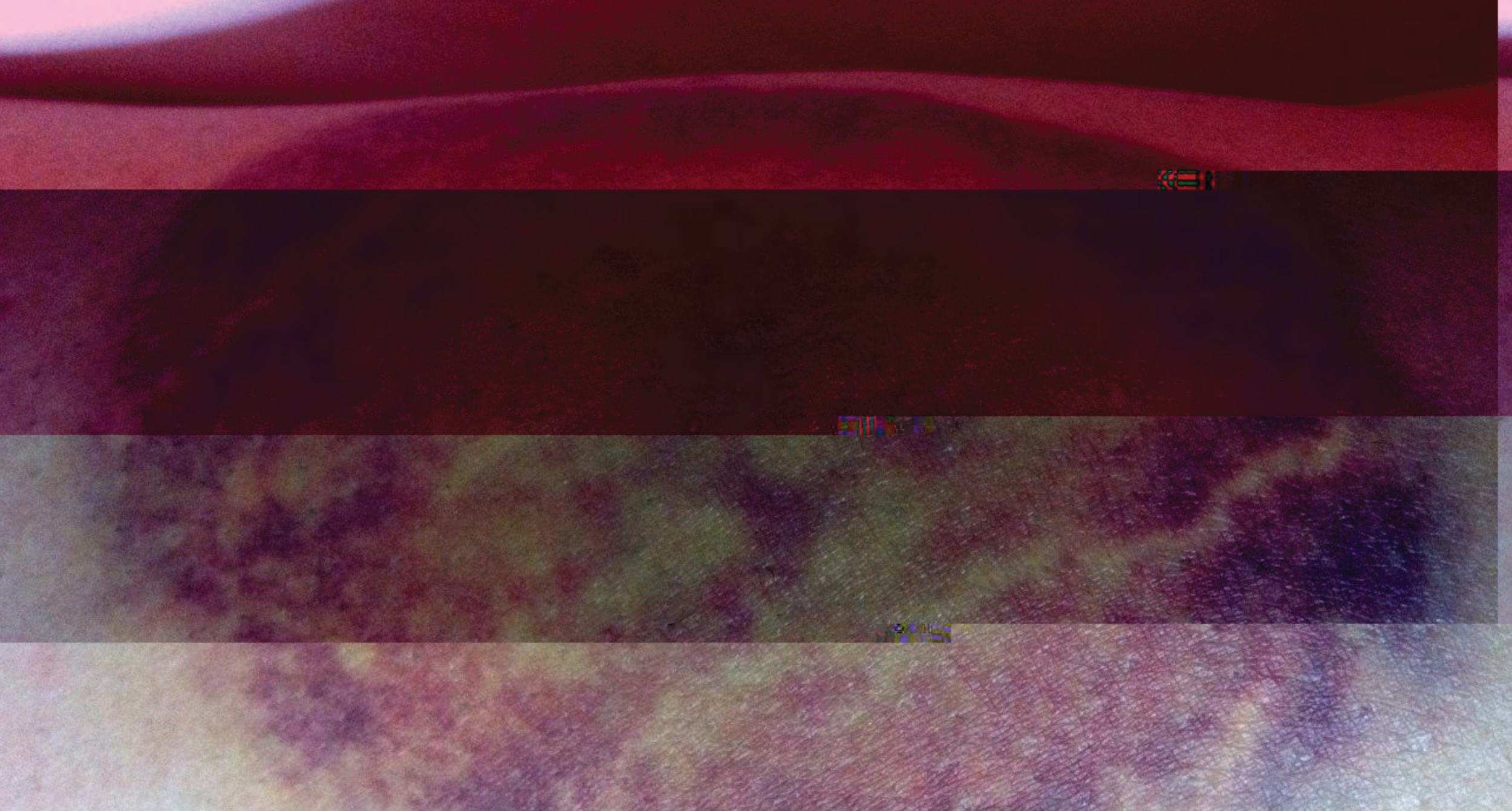 final_bruise-book_cover-2.png