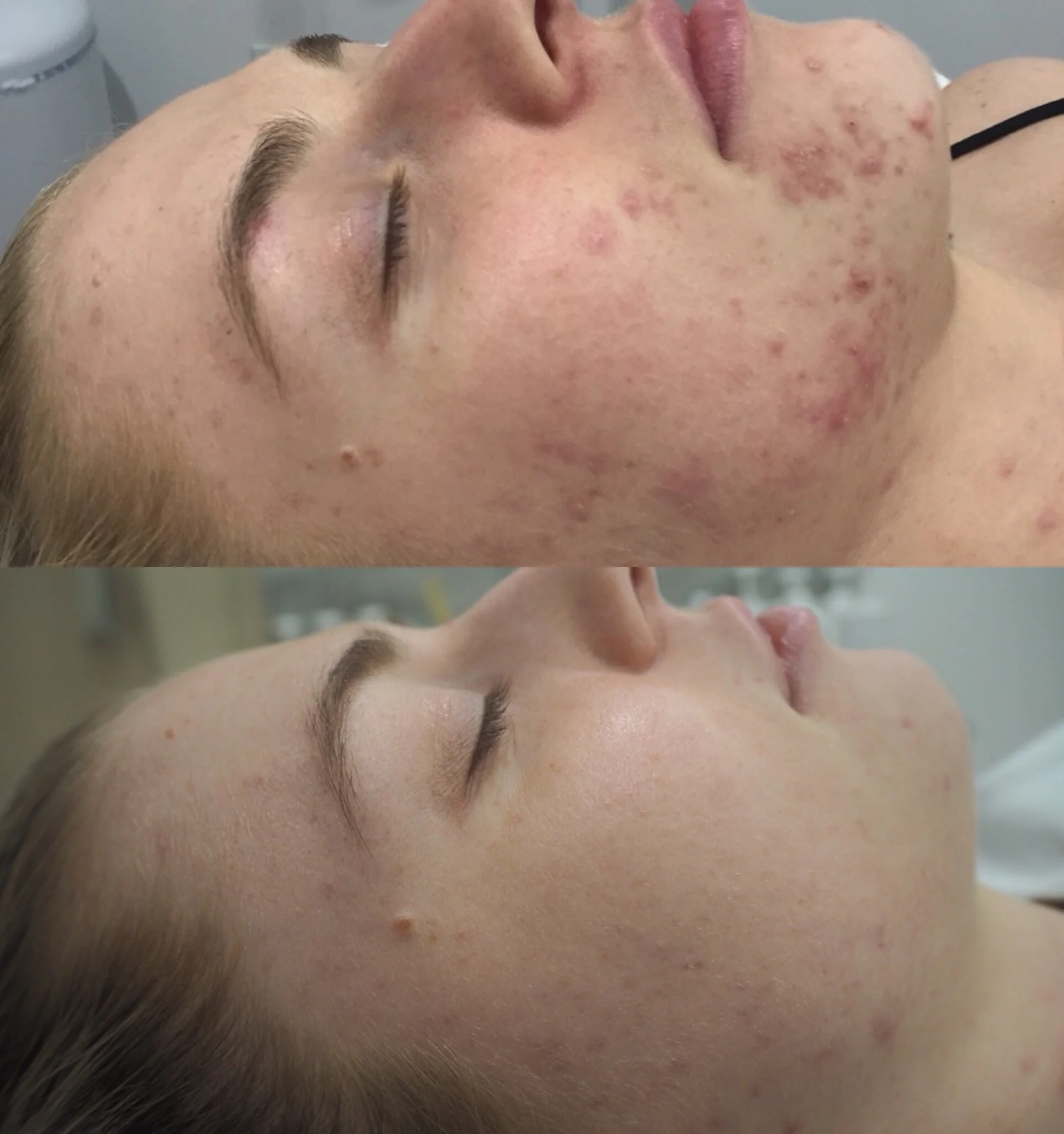 Treatments: 6x Nutrition Facial. Homecare: Cleansing Milk with DMS, Lotion P, Custom Blend High Classic Moisturiser.