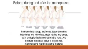Menopause-Breast-300x169.jpg