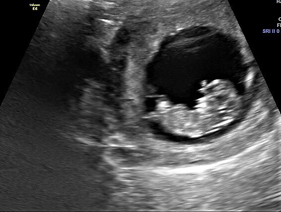 11 weeks 2.jpg