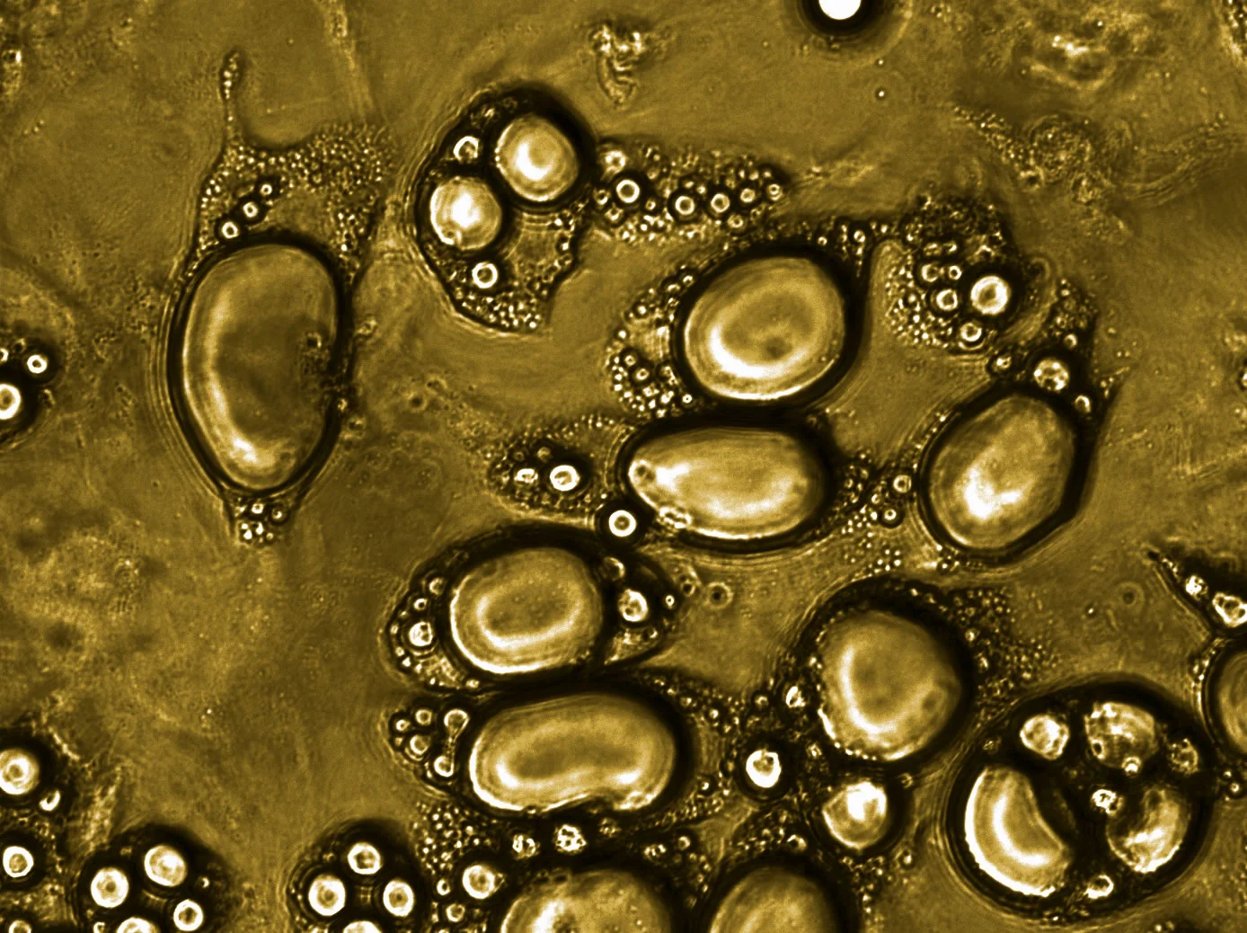 Figure 1. Adipose tissue (left) and adipocytes (right)
