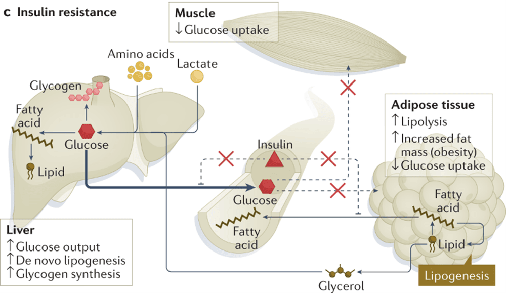 glutathione and insulin resistance Oxidative Stress and its Implications for Male Reproductive Dysfunction:  Mechanistic Insights, Clinical Impacts, and Advances in Therapeutic  Interventions - Yu - Andrology