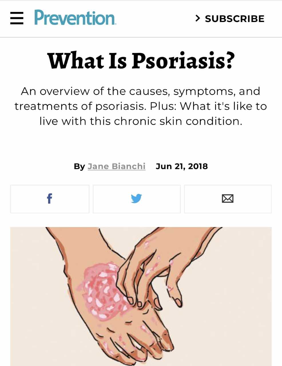 prevention-psoriasis.jpeg