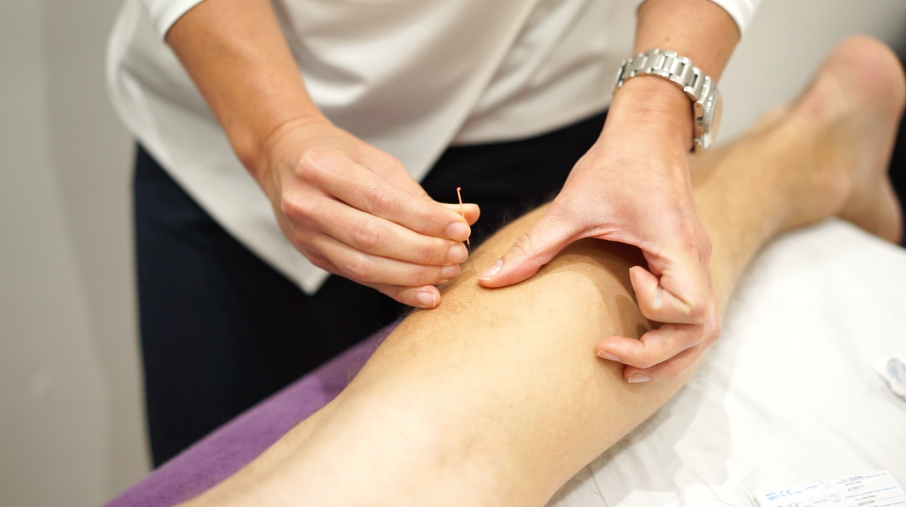 SE1physio_acupuncture