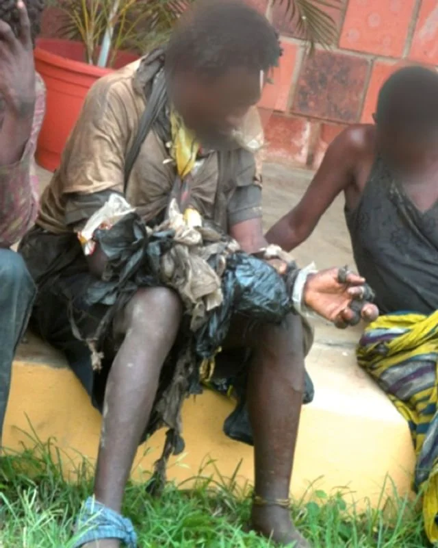 A heart touching story of Mr Ebere picked from the street at the Holy Rosary bus stop. Read the full story of his road to recovery with Amaudo. A painful story of losing fingers to gaining sanity and meeting his family. Support Amaudo where good things happen..
#mentalhealth #health #life #story #hope #mentalillness #EndTheStigma #AmaudoChangedMyStory #volunteer #activism #postgrad #experience #Nigeria #tbt #30years30stories #mentalhealthawarness #recovery
https://www.amaudo.org/30-years/2019/7/11/eberes-story