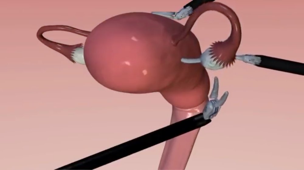 Subdermal Plasticity: Research Files — EMILY GARDNER Subdermal Plasticity: Research Files — EMILY GARDNER
