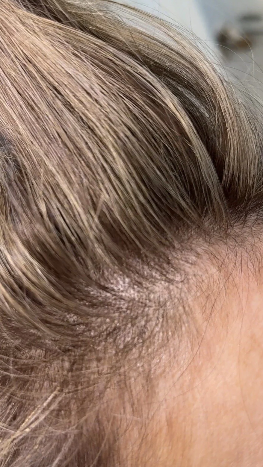 Detailed micro-highlight work, natural grow-out, Frisco TX blonde specialist. Every section fine-tuned so nothing reads as "highlighted" — just naturally lighter.