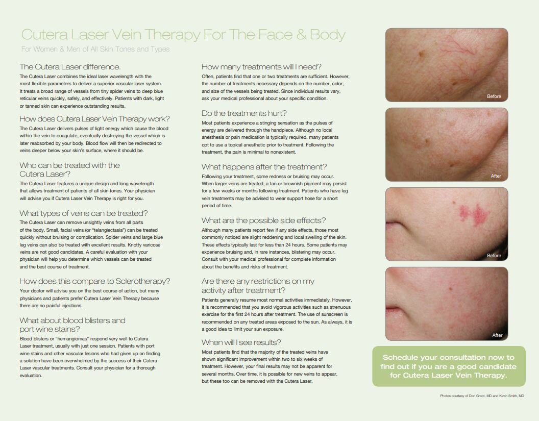 Vein Therapy Brochure 2.JPG