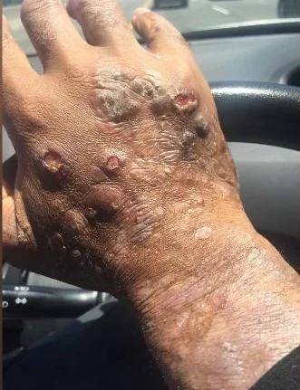 Monsanto cancer.jpg