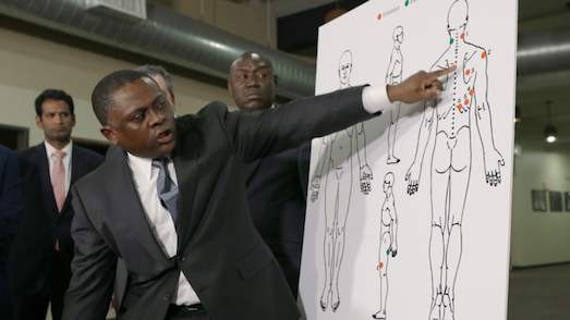 Dr. Bennet Omalu, is a famed pathologist best known for the initial discovery of NFL brain injuries. On Dec. 5, 2017, Omalu resigned from the San Joaquin County coroner's office accusing Sheriff-Coroner Steve Moore of interfering with death investig…
