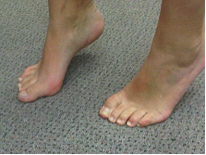bunion.exercise-3.png