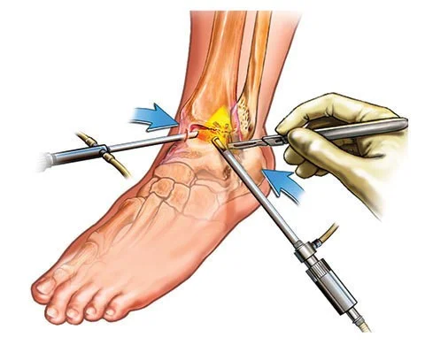 Image Credit: Murdoch Orthopaedic Clinic