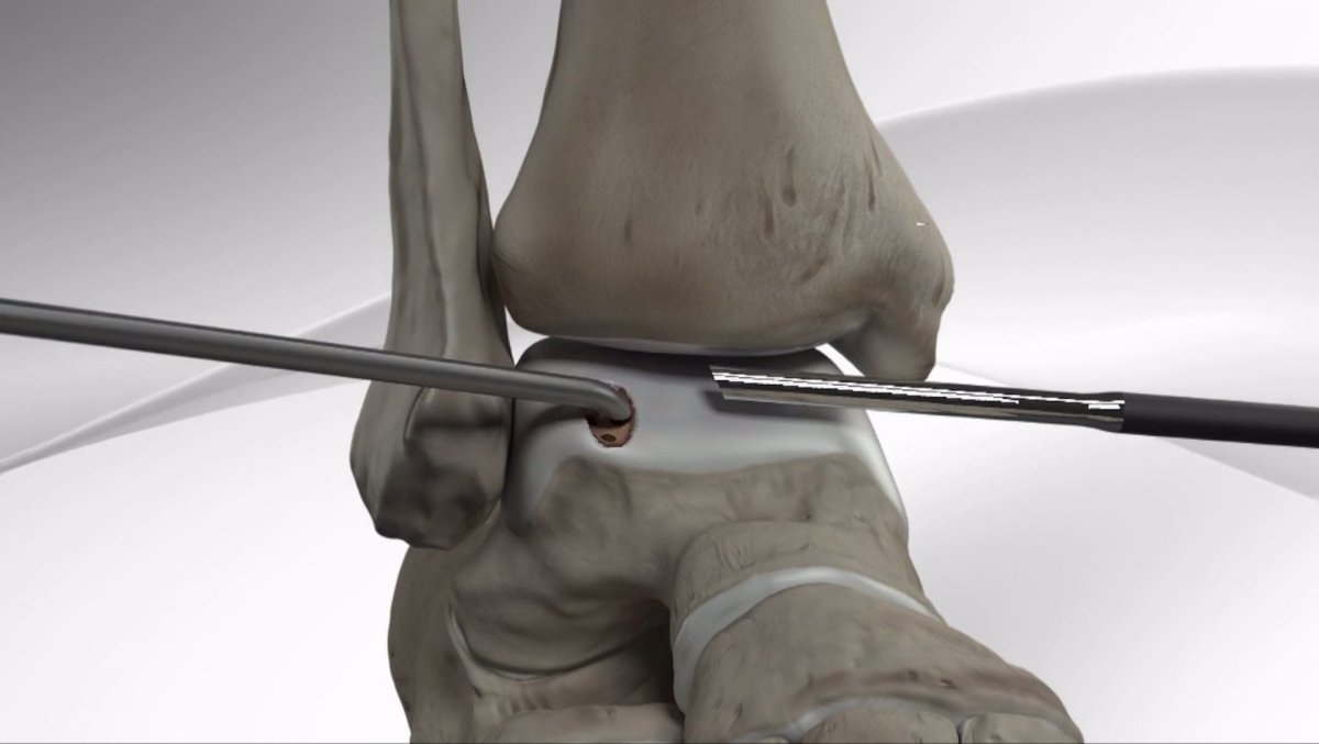 BioCartilage.jpg