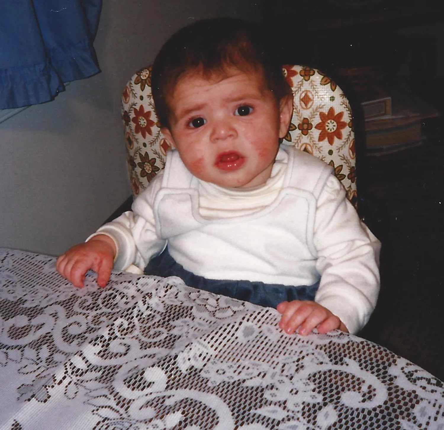 "It was overwhelming at first," my mom says. "You had rashes. You had cradle cap. You were scratching everywhere. We were just trying to keep you comfortable."