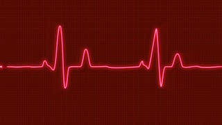 heart+beat.jpg
