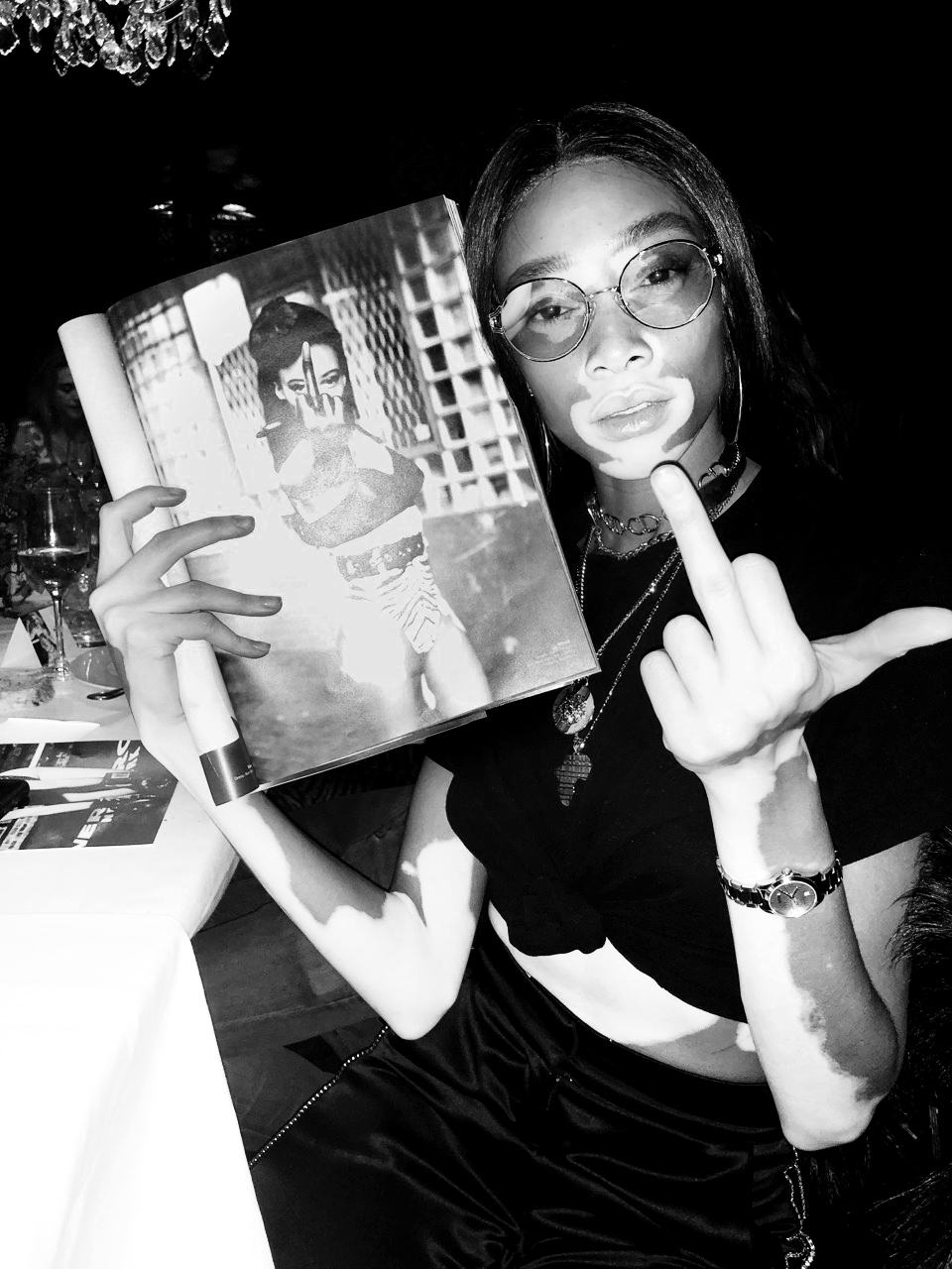 Winnie Harlow