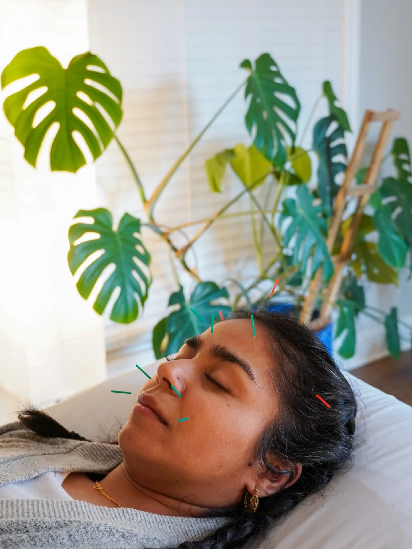 If you&rsquo;re looking for a more natural approach to skin rejuvenation in Charleston, facial rejuvenation treatments can be a beautiful alternative, or complement to Botox💫

Instead of focusing on freezing movement, this treatment approach focuses