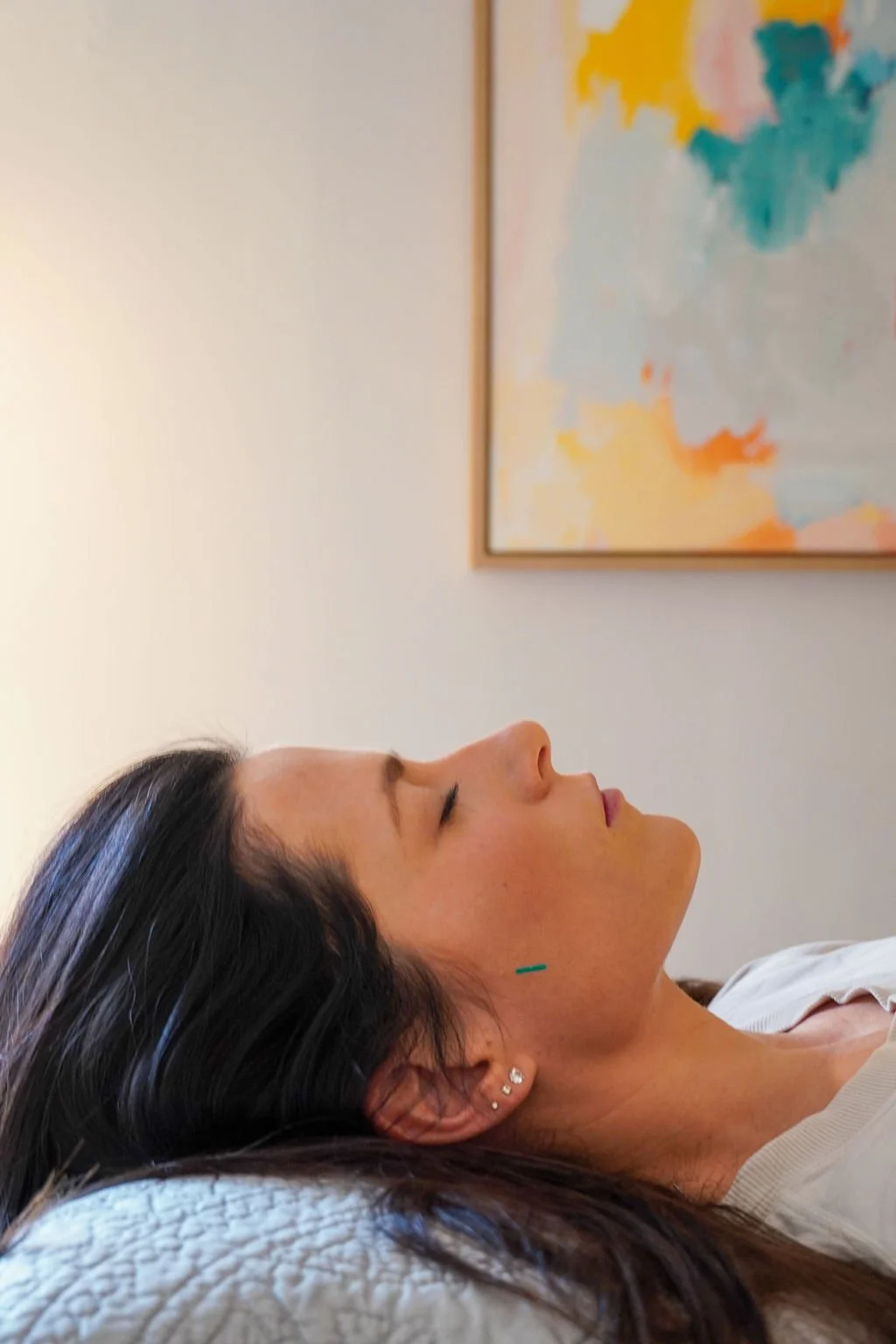 Woman with acupuncture needle in face during session at work in Charleston, SC