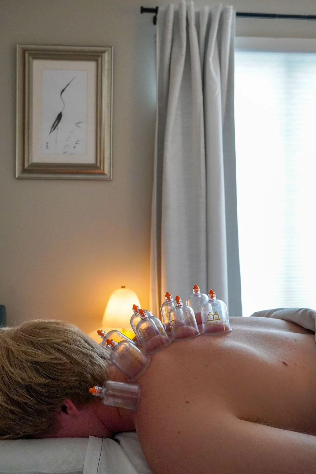 A medical professional performing moxibustion on a patient's lower legs in a peaceful clinic setting.