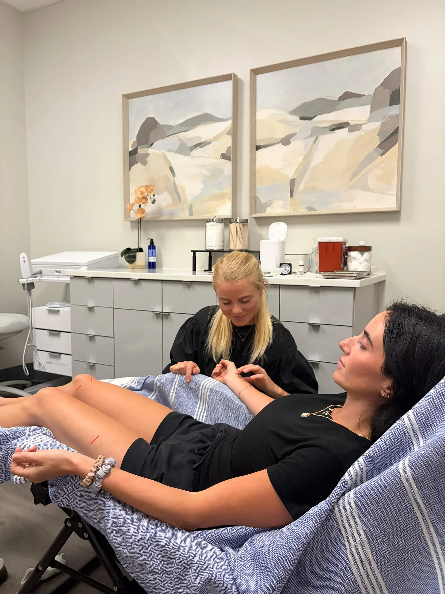 Acupuncture in office during employee wellness event in Charleston