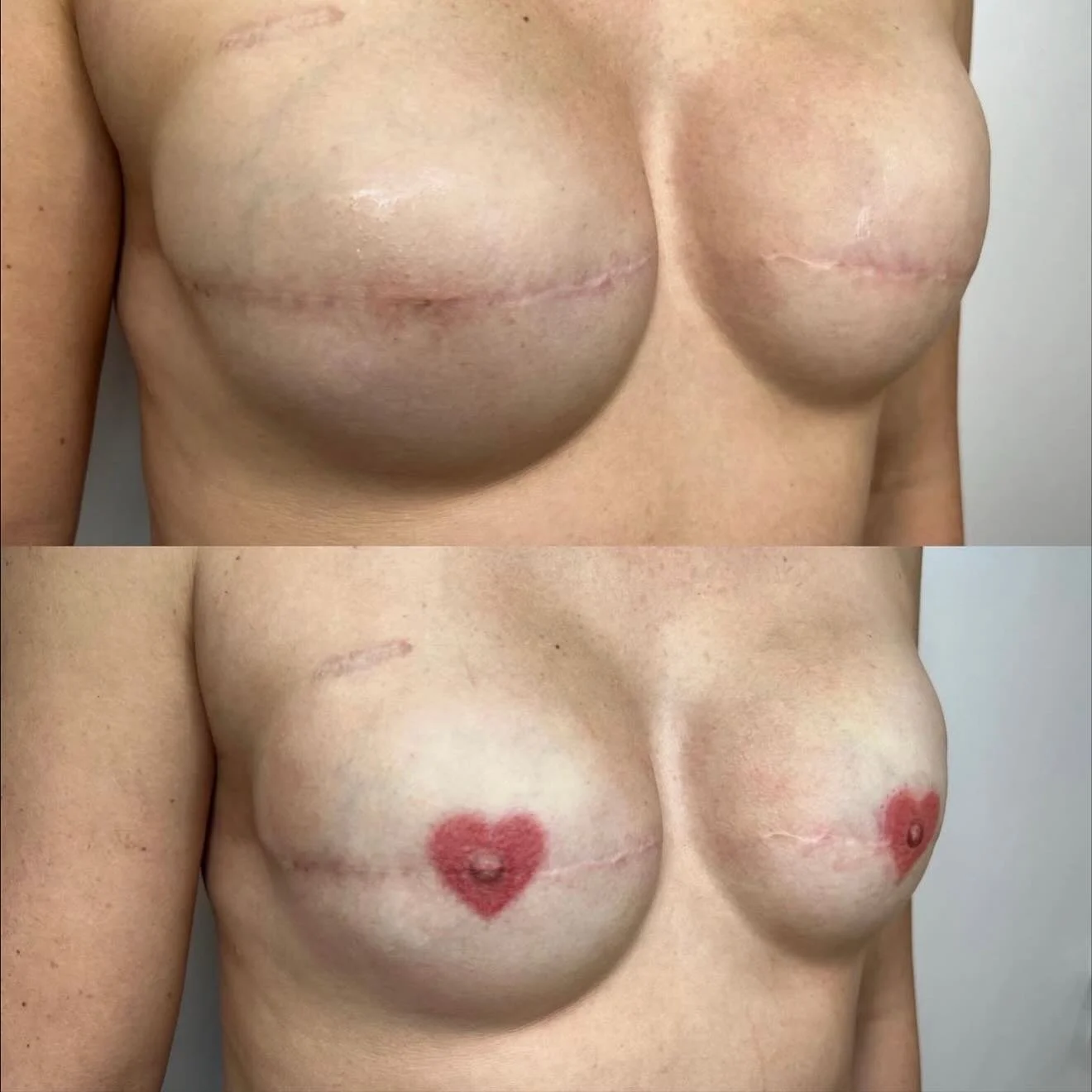 Shan @thebrowrecluse will be back in a few weeks and has a few spots left for brows, lips and Areola 🩷🩷🩷🩷🩷