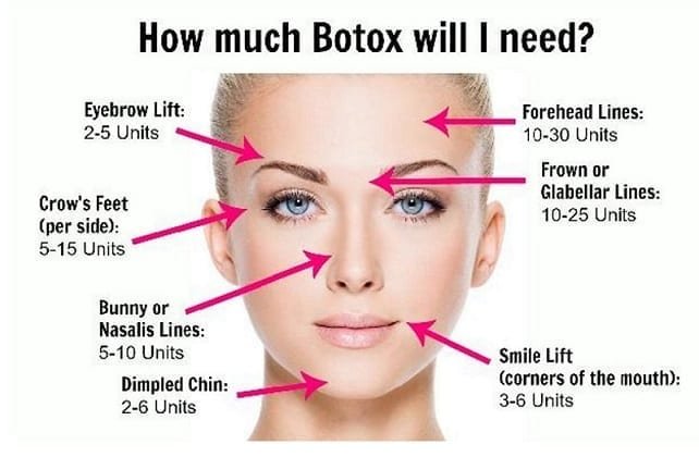Allergan Botox 