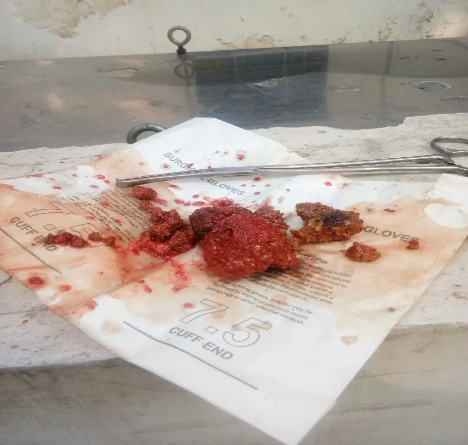May 2019 Stone removed.jpg