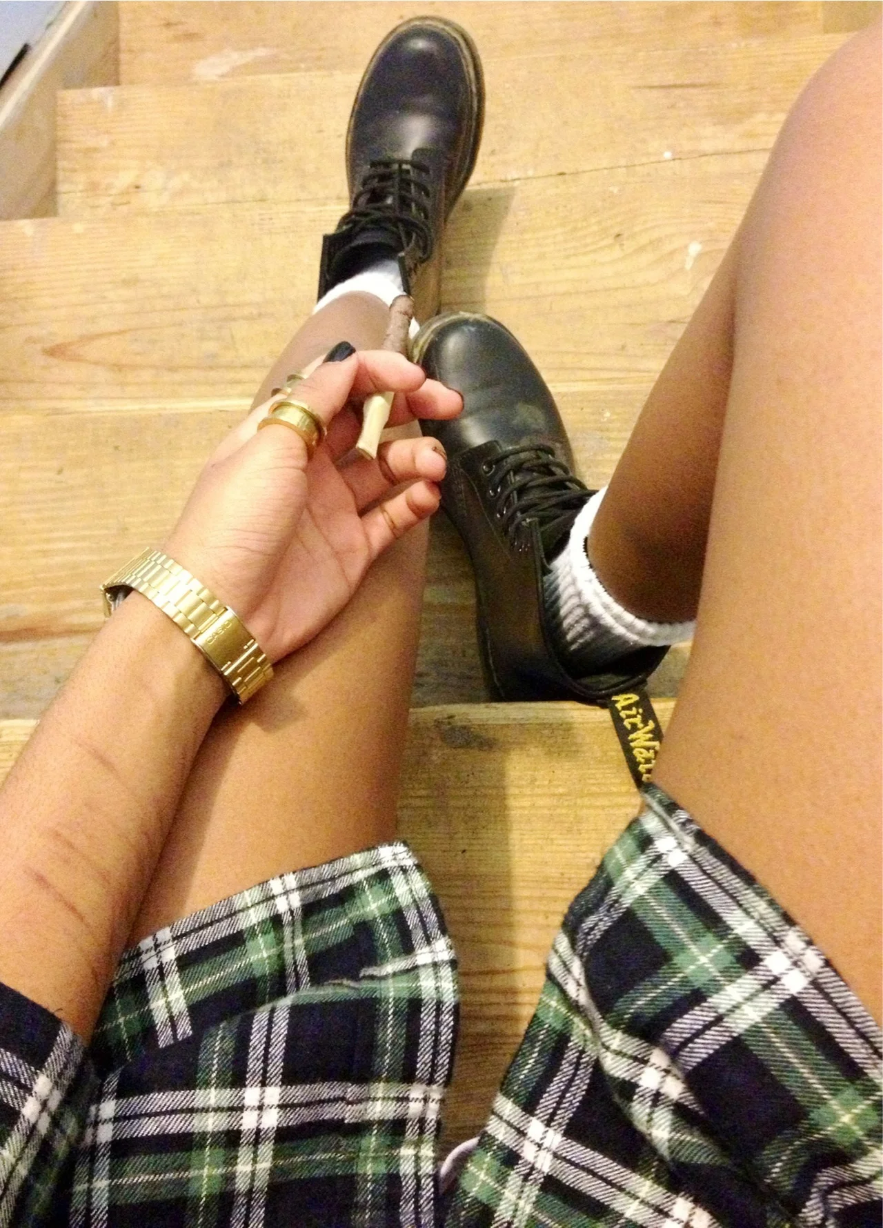 chanel-and-louboutins:

beyourfxckingself:

askaboutnikki:

Dressing Like Its Not November


i like that outfit.

Chanel-and-Louboutins.tumblr.com

People like this picture for the outfit..But I simply cannot get the cuts out of my mind.Forget the c…