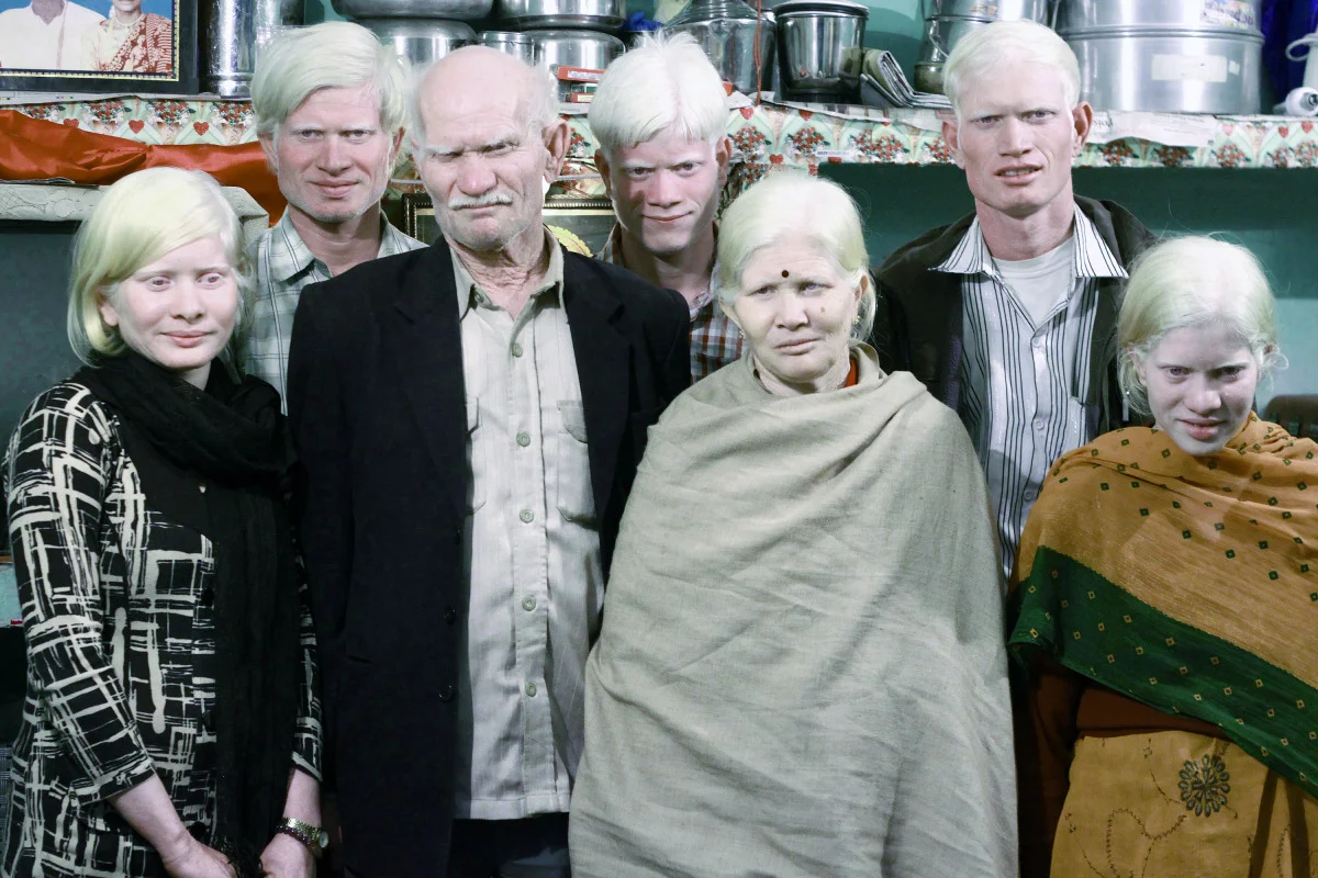hoeswithclothes:

losed:


Albino Indian Family

this is amazing

Love albinos so sexy

&hellip;!!