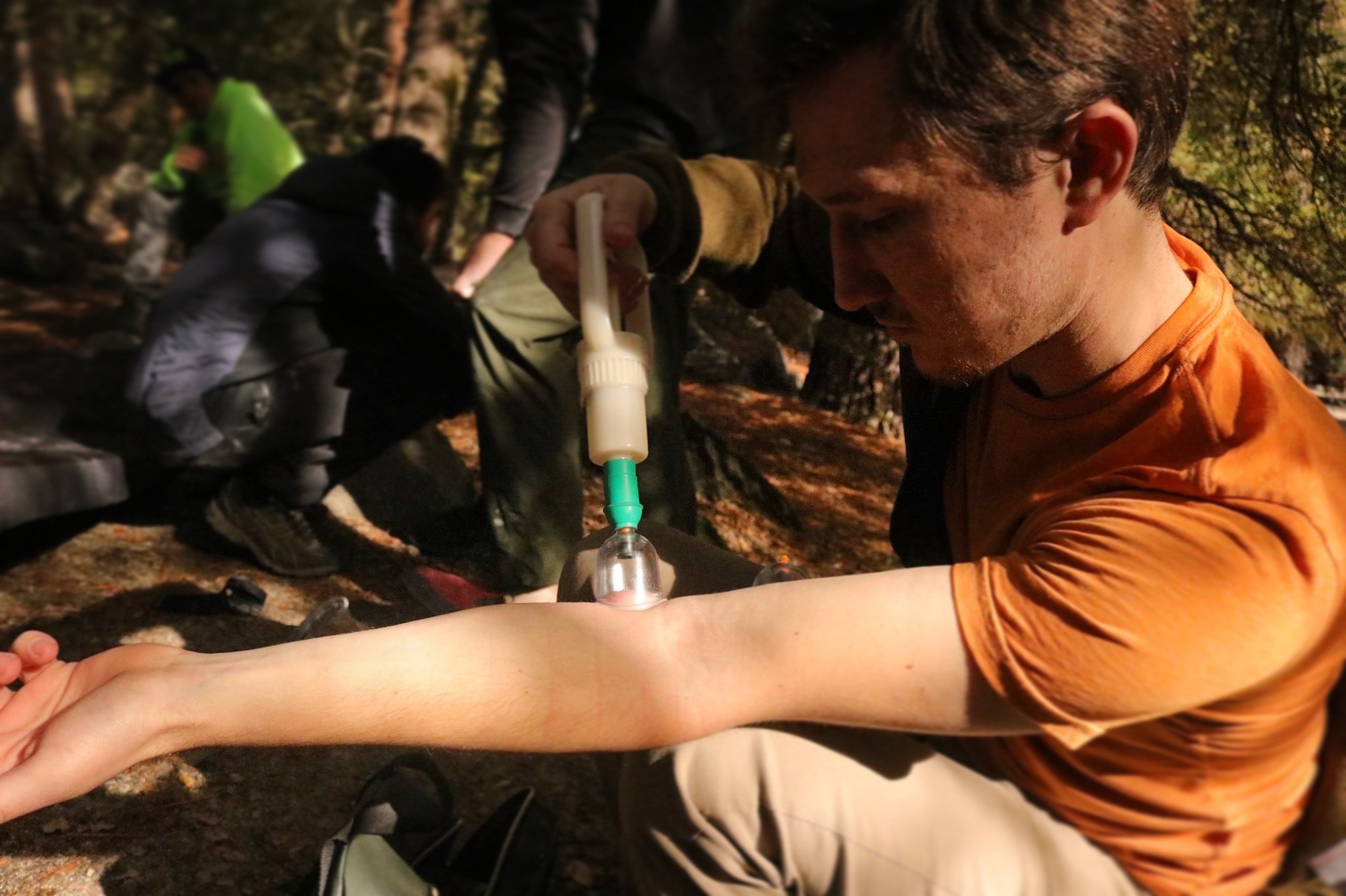 Self-Cupping Therapy in Yosemite