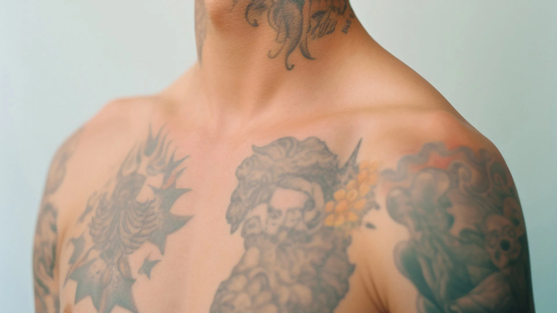 Why Laser Tattoo Removal Is Ideal for Getting Rid of Old Tattoos