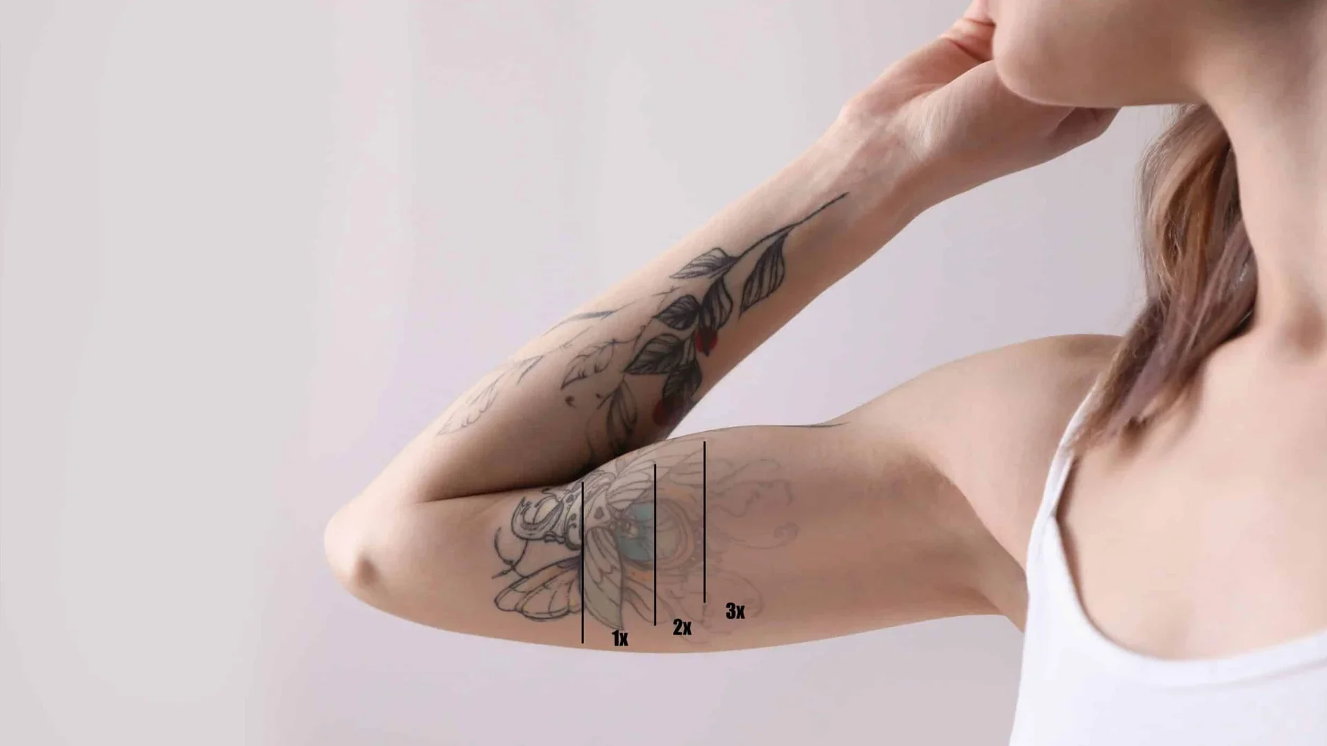 How Much of a Tattoo Needs to Be Removed Before a Cover Up?