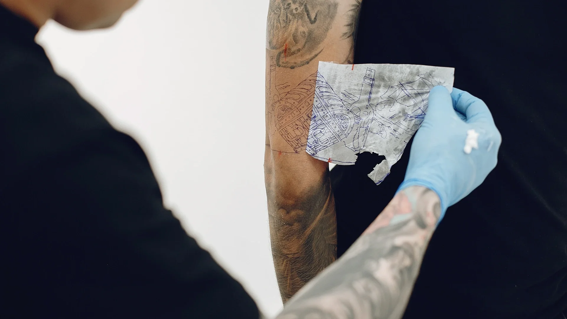 How to Choose the Best Tattoo Removal Service in the Sutherland Shire