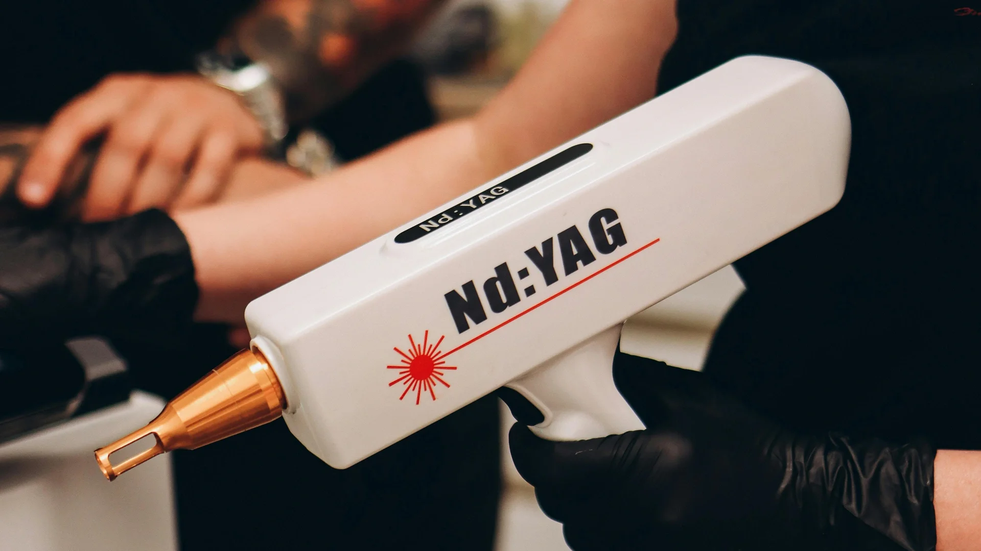 The Reality of Tattoo Removal: Time, Cost, and Why Many Choose Cover-Ups Instead