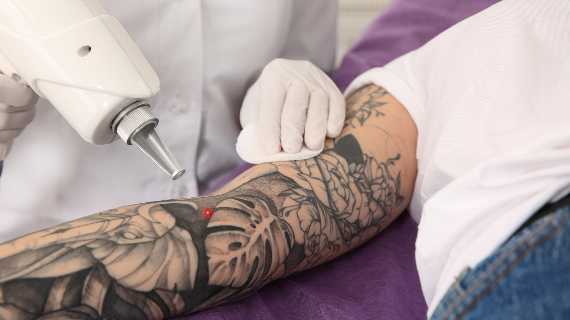 Laser Tattoo Removal in Sutherland Shire: Choosing the Right Clinic Matters