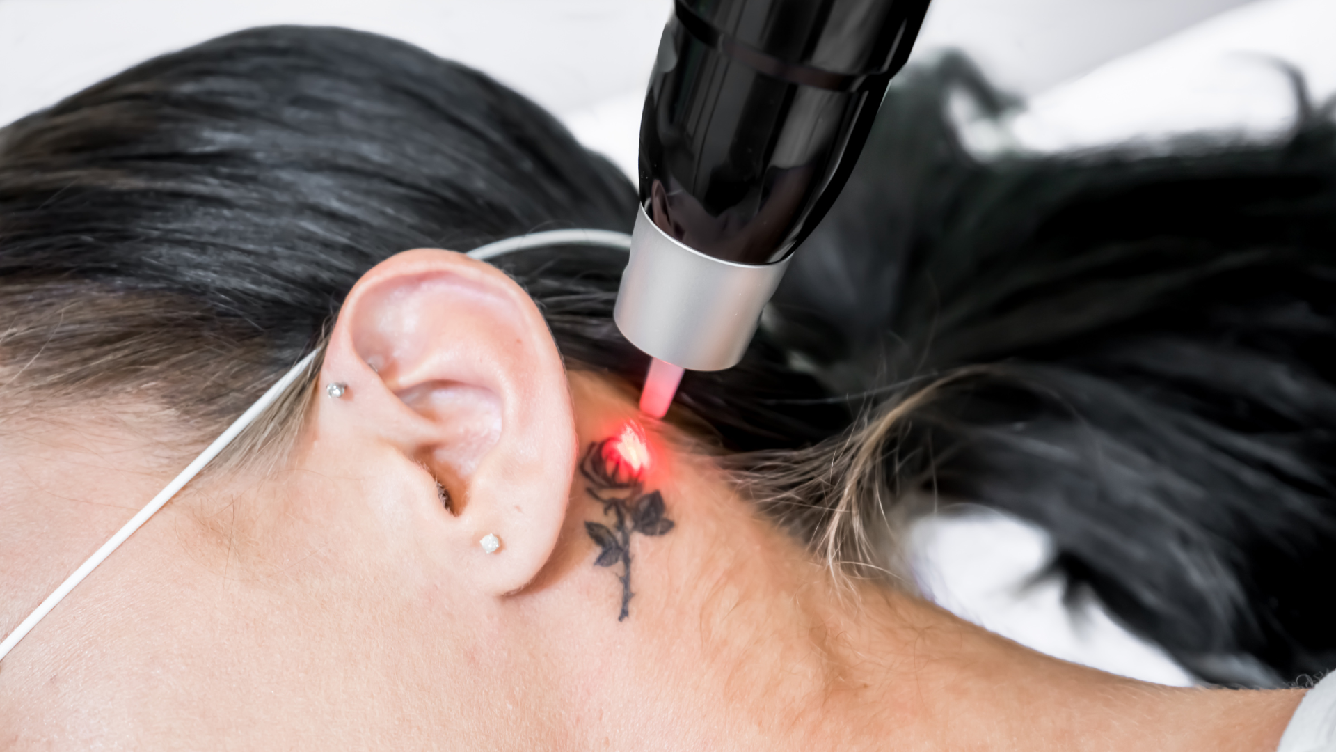 Why Tattoo Placement Can Change the Pace of Removal