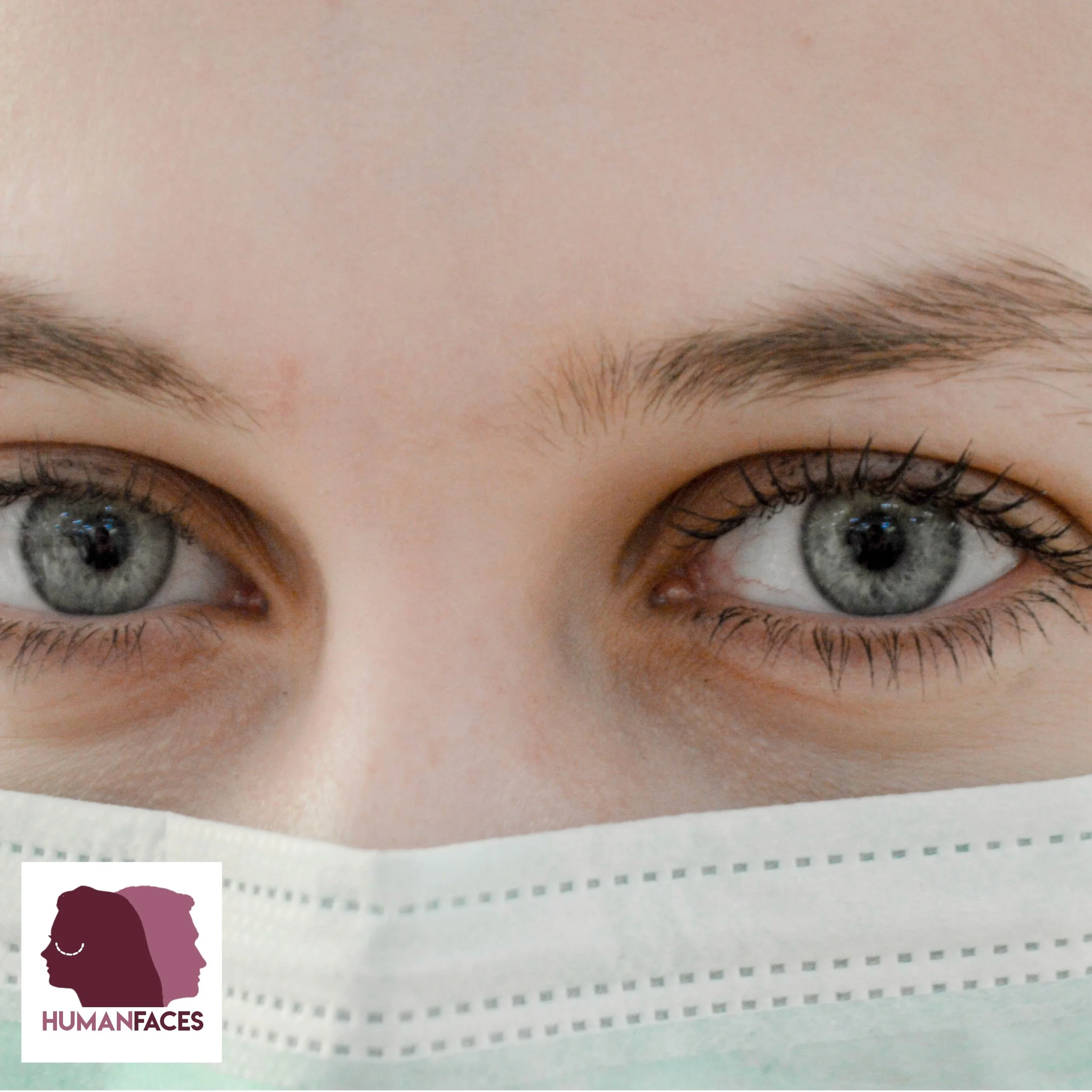 Does your face need botox?